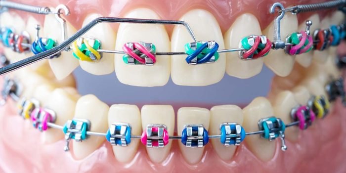 orthodontics